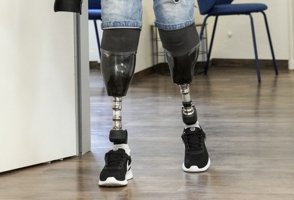 Ο Βρετανός χειρουργός Νιλ Χόπερ που ακρωτηρίασε τα πόδια του για σεξουαλική εμμονή
