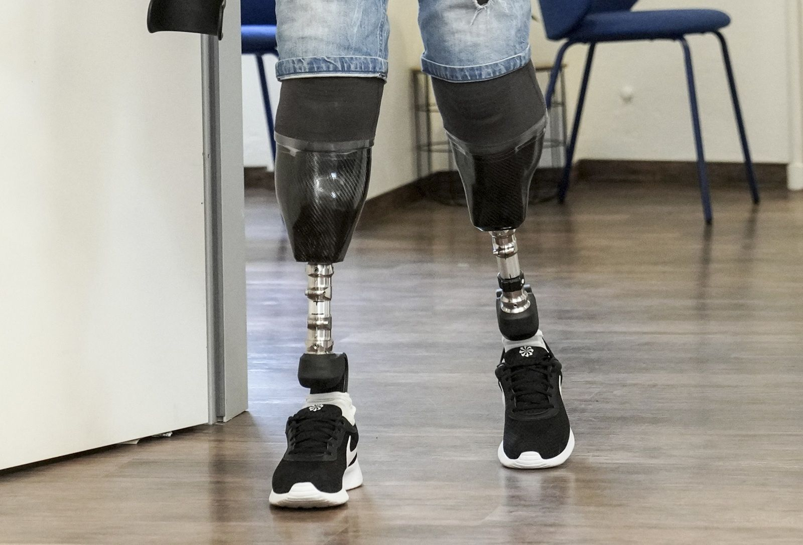 Ο Βρετανός χειρουργός Νιλ Χόπερ που ακρωτηρίασε τα πόδια του για σεξουαλική εμμονή